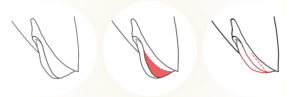 labioplastika v praze